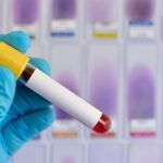 test-coronavirus