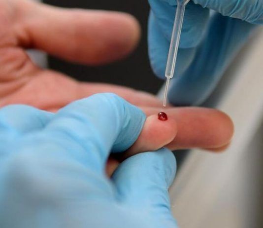 covid Fuerteventura altas casos