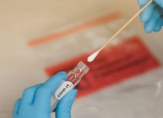 Canarias test covid 19 cabildo