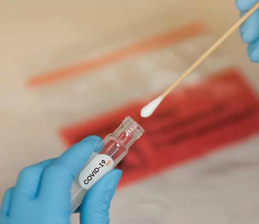 Canarias test covid 19 cabildo